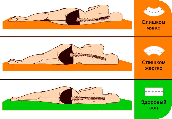 Festigkeit der orthopädischen Matratze